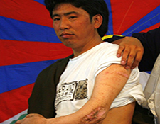 Drango, Kham Tibet Wounded Monk
